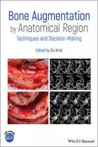 https://www.dentalbooks.org/wp-content/uploads/2020/05/Bone-Augmentation-by-Anatomical-Region-200x300.jpg