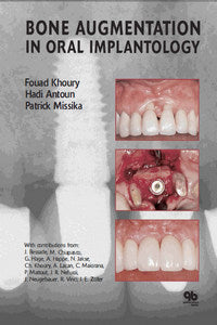 https://www.dentalbooks.org/wp-content/uploads/2019/02/Bone-Augmentation-in-Oral-Implantology.jpg