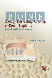 https://www.dentalbooks.org/wp-content/uploads/2019/02/Bone-Biology-Harvesting-Grafting-For-Dental-Implants.jpg
