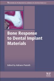 https://www.dentalbooks.org/wp-content/uploads/2019/05/Bone-Response-to-Dental-Implant-Materials-180x270.jpg