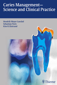 https://www.dentalbooks.org/wp-content/uploads/2019/02/Caries-Management-Science-and-Clinical-Practice.jpg