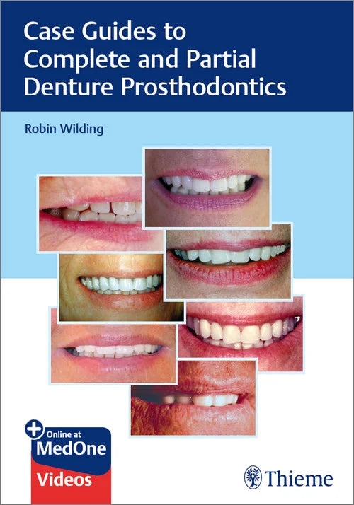 https://dentalmp4.com/wp-content/uploads/2024/04/Case-Guides-to-Complete-and-Partial-Denture-Prosthodontics.webp