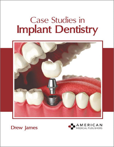https://dentalmp4.com/wp-content/uploads/2024/09/Case-Studies-in-Implant-Dentistry.jpg