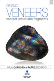 https://www.dentalbooks.org/wp-content/uploads/2019/02/Ceramic-Veneers-Contact-Lenses-and-Fragments-2-180x270.jpg