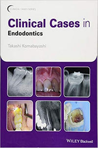 https://www.dentalbooks.org/wp-content/uploads/2019/02/Clinical-Cases-in-Endodontics.jpg