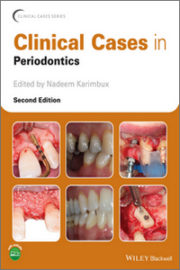 https://www.dentalbooks.org/wp-content/uploads/2022/01/Clinical-Cases-in-Periodontics-2nd-Edition-180x270.jpg