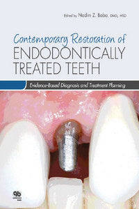 https://www.dentalbooks.org/wp-content/uploads/2019/02/Contemporary-Restoration-of-Endodontically-Treated-Teeth.jpg
