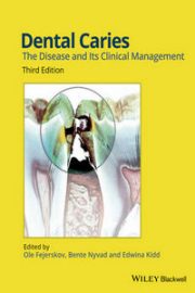 https://www.dentalbooks.org/wp-content/uploads/2019/03/Dental-Caries-The-Disease-and-Its-Clinical-Management-3rd-Edition-180x270.jpg