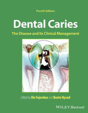 https://dentalmp4.com/wp-content/uploads/2024/07/Dental-Caries_The-Disease-and-its-Clinical-Management-4th-Edition.jpg