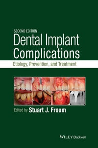 https://www.dentalbooks.org/wp-content/uploads/2019/02/Dental-Implant-Complications-Etiology-Prevention-and-Treatment-2nd-edition.jpg