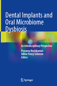https://dentalmp4.com/wp-content/uploads/2022/06/Dental-Implants-and-Oral-Microbiome-Dysbiosis.jpg