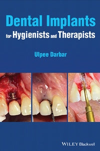 https://dentalmp4.com/wp-content/uploads/2022/04/Dental-Implants-for-Hygienists-and-Therapists.jpg