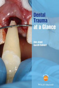https://dental-books.com/wp-content/uploads/2022/05/Dental-Trauma-at-a-Glance.jpg