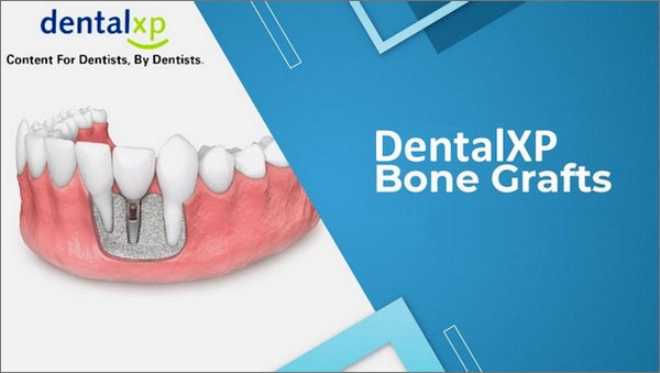 https://dental-books.com/wp-content/uploads/2023/07/DentalXP-Bone-Grafts.jpg