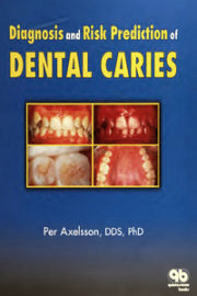 https://www.dentalbooks.org/wp-content/uploads/2021/05/Diagnosis-and-Risk-Prediction-of-Dental-Caries-Volume-2-1st-Edition-180x270.jpg