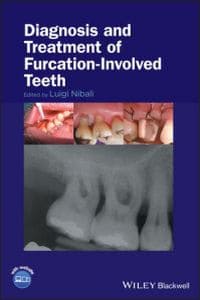 https://www.dentalbooks.org/wp-content/uploads/2019/03/Diagnosis-and-Treatment-of-Furcation%E2%80%90Involved-Teeth.jpg