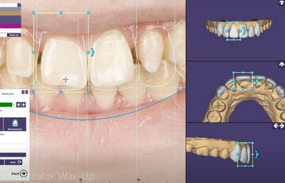 https://dental-books.com/wp-content/uploads/2023/03/Digital-Design-in-Exocad-2.jpg