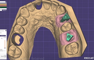 https://dental-books.com/wp-content/uploads/2023/03/Digital-Design-in-Exocad-3.jpg