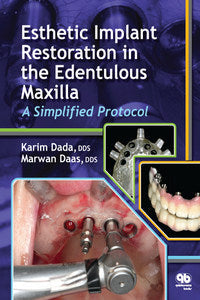 https://www.dentalbooks.org/wp-content/uploads/2019/02/Esthetic-Implant-Restoration-in-the-Edentulous-Maxilla-A-Simplified-Protocol.jpg