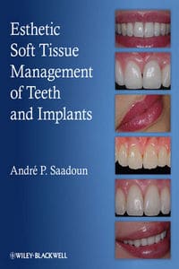 https://www.dentalbooks.org/wp-content/uploads/2019/02/Esthetic-Soft-Tissue-Management-of-Teeth-and-Implants.jpg