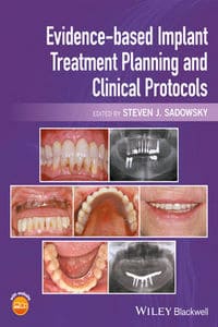 https://www.dentalbooks.org/wp-content/uploads/2019/02/Evidence-based-Implant-Treatment-Planning-and-Clinical-Protocols.jpg