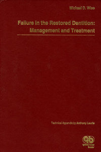 https://www.dentalbooks.org/wp-content/uploads/2019/02/Failure-in-the-Restored-Dentition-Management-and-Treatment.jpg