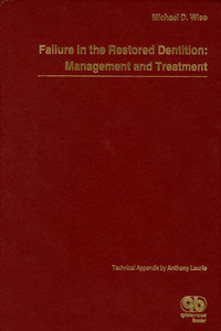 https://www.dentalbooks.org/wp-content/uploads/2019/02/Failure-in-the-Restored-Dentition-Management-and-Treatment.jpg