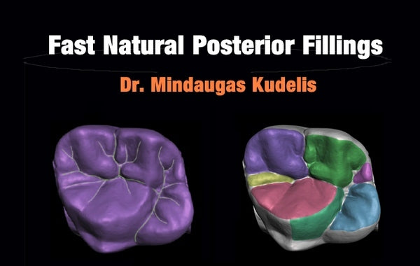 https://dentalmp4.com/wp-content/uploads/2023/03/Fast-Natural-Posterior-Fillings-2.jpg