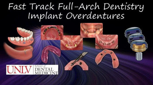 https://dentalmp4.com/wp-content/uploads/2022/12/Fast-Track-Full-Arch-Dentistry_Implant-Overdentures.jpg