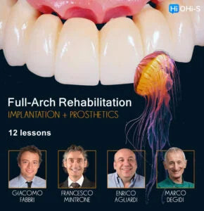 https://dentalmp4.com/wp-content/uploads/2024/05/Full-Arch-Rehabilitation-Implantation-and-Prosthetics.webp