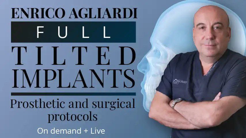 https://dentalmp4.com/wp-content/uploads/2023/07/Full-Tilted-Implants_Prosthetic-and-Surgical-Protocols.jpg