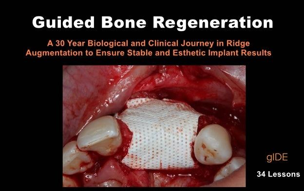 https://dentalmp4.com/wp-content/uploads/2023/04/Guided-Bone-Regeneration-a-30-year-Biological-2.jpg