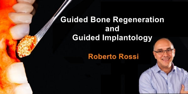 https://dentalmp4.com/wp-content/uploads/2023/06/Guided-regeneration-Guided-Implantology.jpg