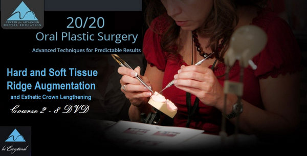 https://dental-books.com/wp-content/uploads/2022/09/Hard-and-Soft-Tissue-Ridge-Augmentation-and-Esthetic-Crown-Lengthening.jpg