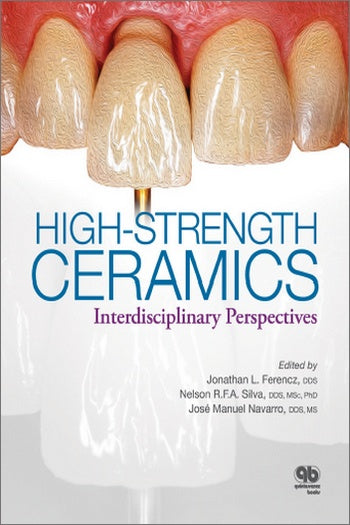 https://dental-books.com/wp-content/uploads/2021/03/High-Strength-Ceramics-Interdisciplinary-Perspectives.jpg