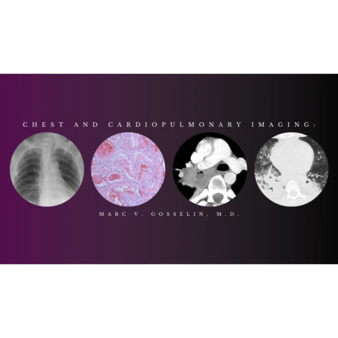CMEScience Chest and Cardiopulmonary Imaging – Marc V. Gosselin, M.D (Videos + PDF)