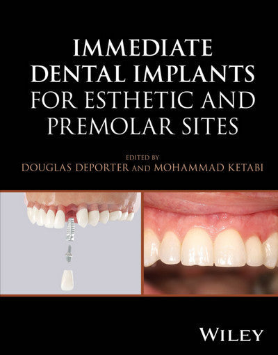 https://dentalmp4.com/wp-content/uploads/2025/05/Immediate-Dental-Implants-for-Esthetic-and-Premolar-Sites.jpg