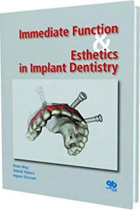https://www.dentalbooks.org/wp-content/uploads/2019/02/Immediate-Function-and-Esthetics-in-Implant-Dentistry.jpg