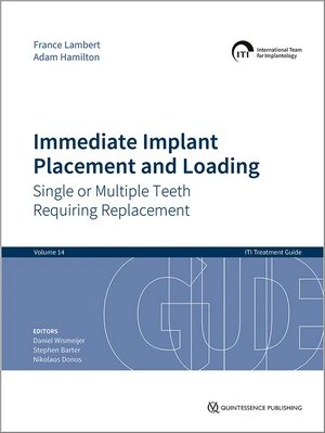 https://dentalmp4.com/wp-content/uploads/2023/11/Immediate-Implant-Placement-and-Loading.jpg