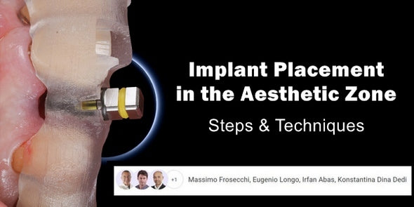 https://dentalmp4.com/wp-content/uploads/2023/06/Implant-Placement-in-the-Aesthetic-Zone-Steps-Techniques.jpg