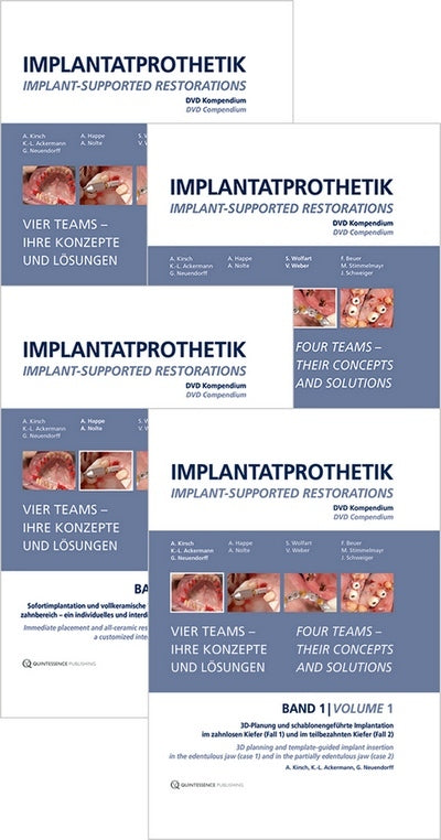 https://dentalmp4.com/wp-content/uploads/2023/04/Implant-Supported-Restorations-Vol1-4-DVD.jpg