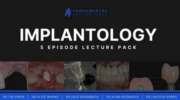https://dentalmp4.com/wp-content/uploads/2023/04/Implantology-5-Episode-Lecture-Pack.jpg