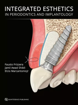 https://dentalmp4.com/wp-content/uploads/2022/08/Integrated-Esthetics-in-Periodontics-and-Implantology-2.jpg