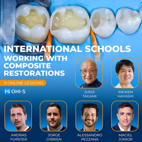 https://dentalmp4.com/wp-content/uploads/2024/02/International-Schools-Working-With-Composite-Restorations.jpg