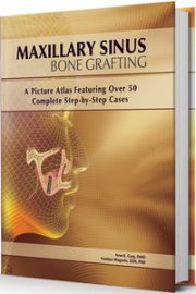https://www.dentalbooks.org/wp-content/uploads/2020/04/Maxillary-Sinus-Bone-Grafting-A-Picture-Atlas-Featuring-over-50-Complete-Step-By-Step-Cases-180x270.jpg
