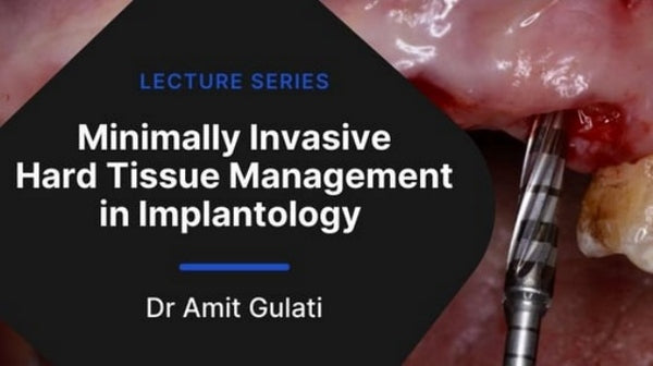 https://dental-books.com/wp-content/uploads/2023/03/Minimally-Invasive-Hard-Tissue-Management-in-Implantology.jpg