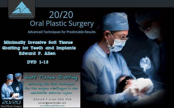 https://dental-books.com/wp-content/uploads/2022/09/Minimally-Invasive-Soft-Tissue-Grafting-for-Teeth-and-Implants.jpg