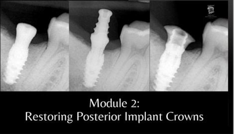 https://dentalmp4.com/wp-content/uploads/2023/11/Module-2.jpg