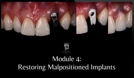 https://dentalmp4.com/wp-content/uploads/2023/11/Module-4.jpg
