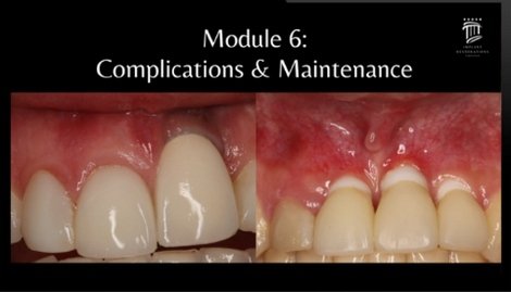 https://dentalmp4.com/wp-content/uploads/2023/11/Module-6.jpg